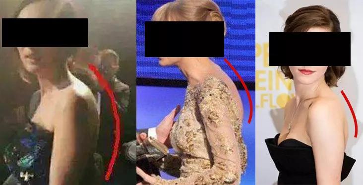 脖子前傾導(dǎo)致形體不佳，氣質(zhì)大打折扣