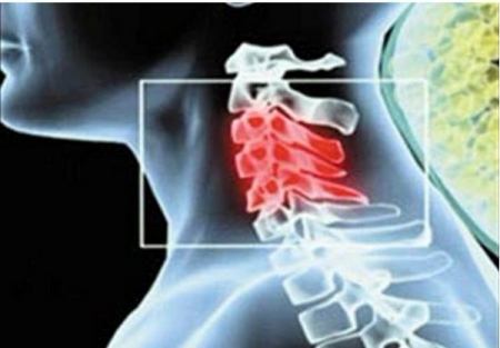 做好這三點(diǎn)、遠(yuǎn)離頸椎病